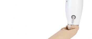 El – Kol Protezleri