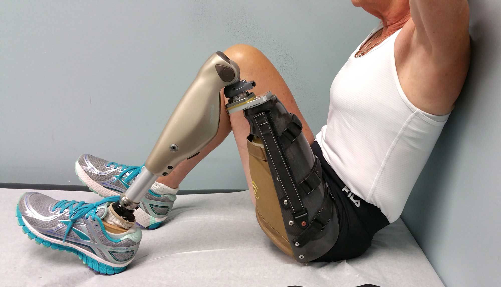 Diz Üstü Ayak Protezleri